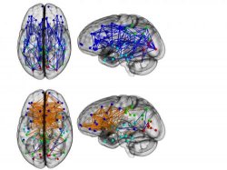 Ученые обнаружили новое различие между мозгом мужчины и женщины