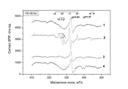 Fig1B